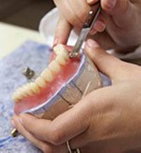 hand carving mold of dentures, Monmouth Junction, NJ